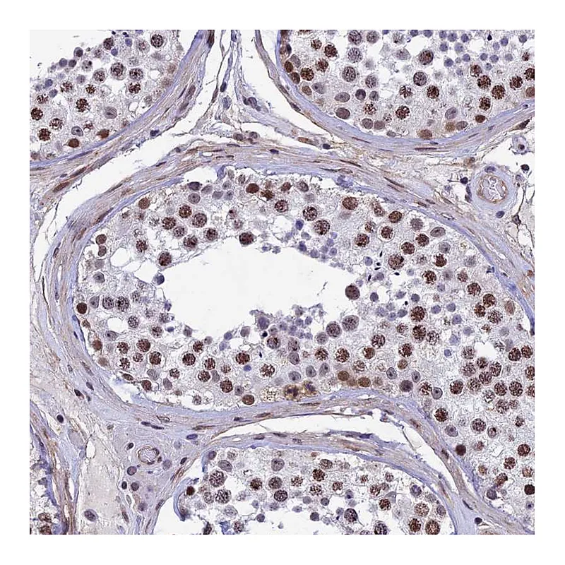 Atlas Antibodies Anti-NIPBL Antibody