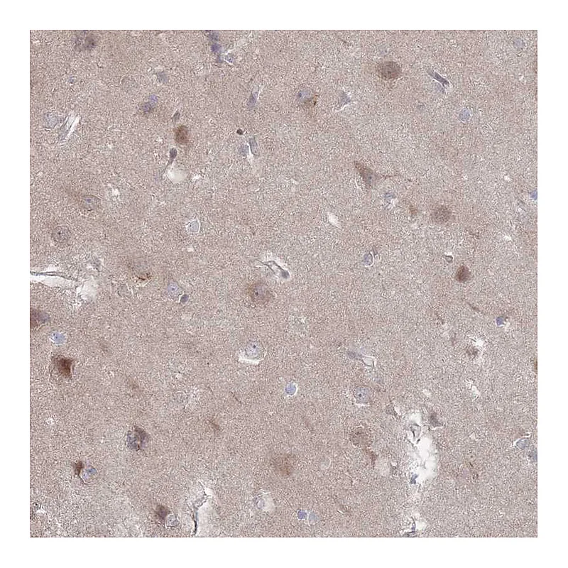Atlas Antibodies Anti-NKD1 Antibody