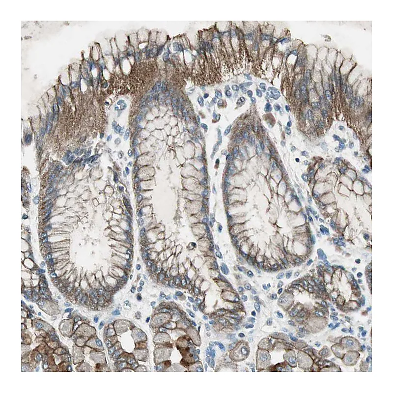Atlas Antibodies Anti-NKAIN1 Antibody