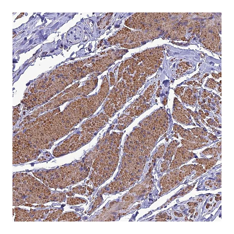 Atlas Antibodies Anti-NKD1 Antibody