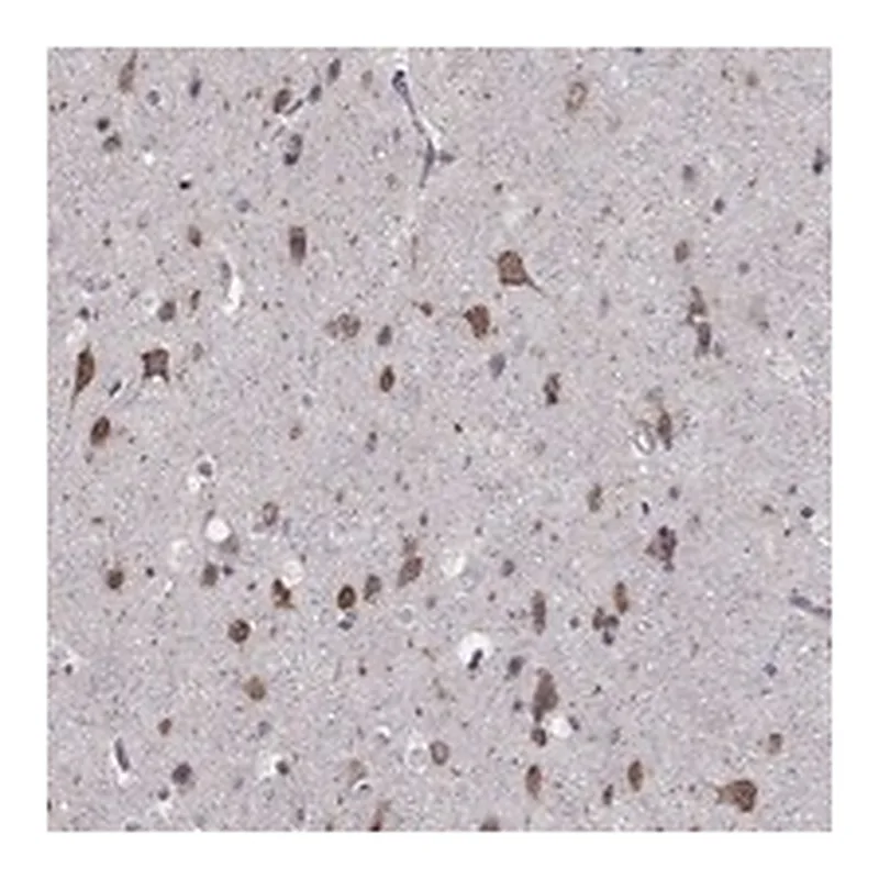 Atlas Antibodies Anti-NKIRAS1 Antibody