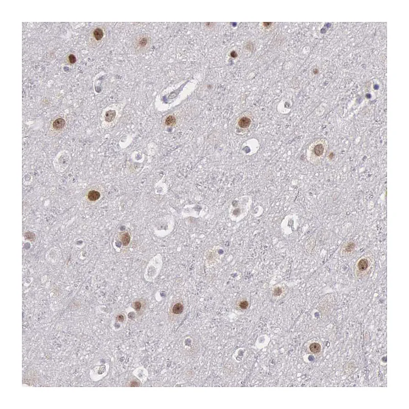 Atlas Antibodies Anti-NKAP Antibody