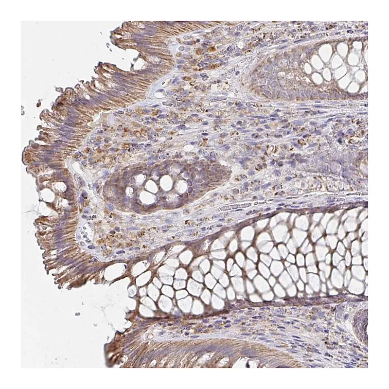 Atlas Antibodies Anti-NKX2-8 Antibody