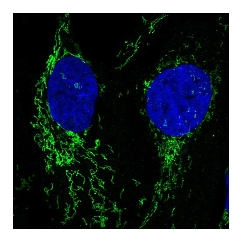 Atlas Antibodies Anti-NLGN2 Antibody