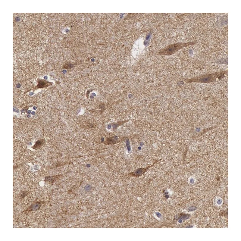 Atlas Antibodies Anti-NLGN4X Antibody