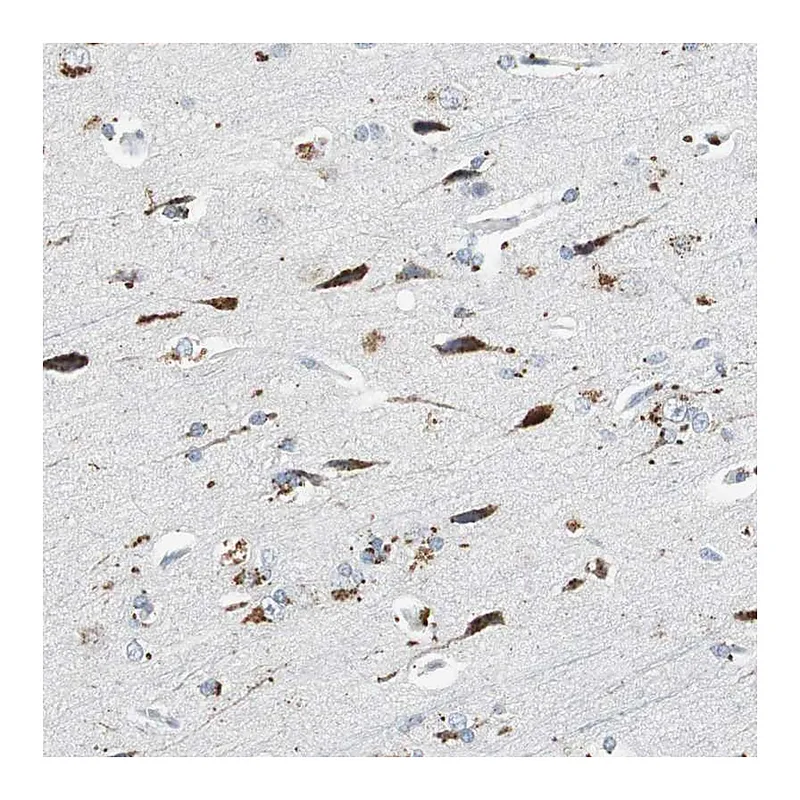 Atlas Antibodies Anti-NLGN1 Antibody