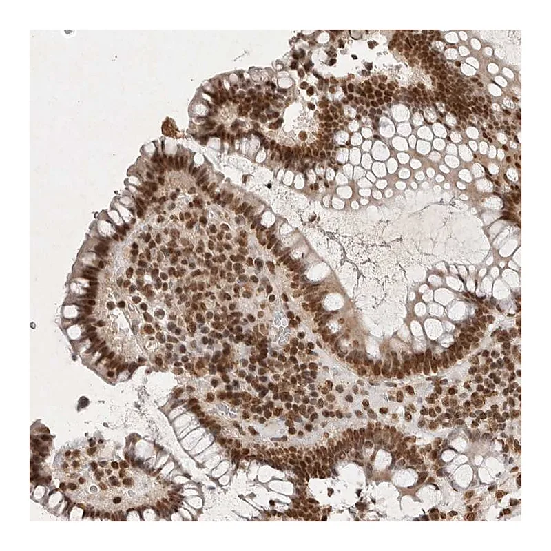 Atlas Antibodies Anti-NKX3-2 Antibody