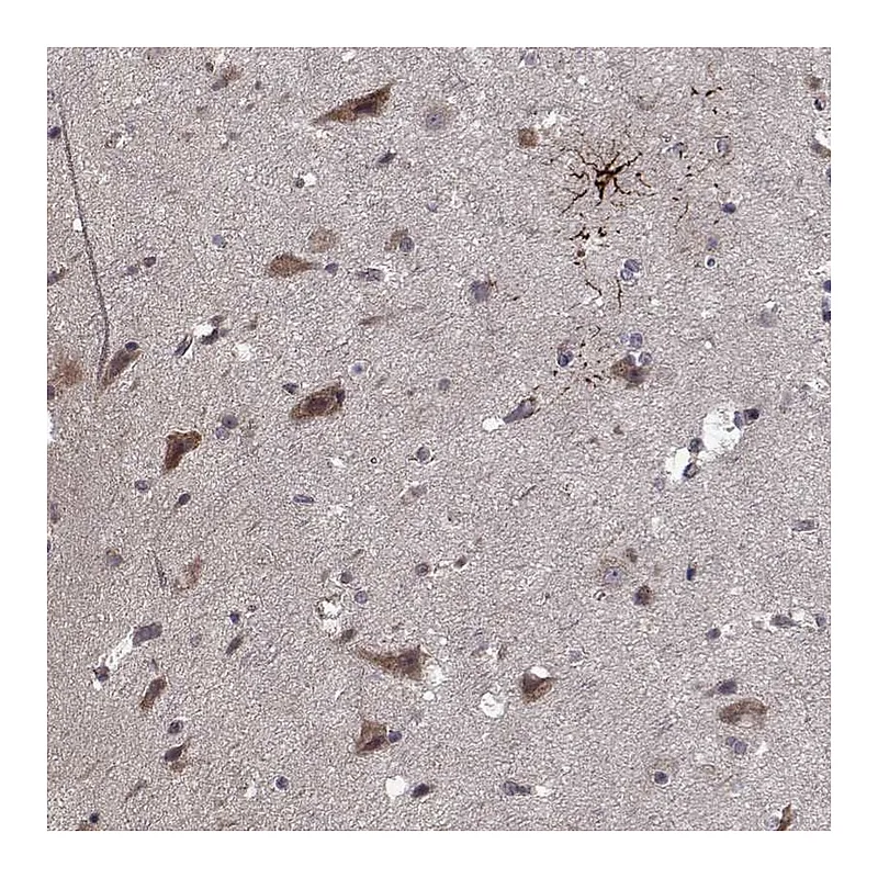 Atlas Antibodies Anti-NLK Antibody