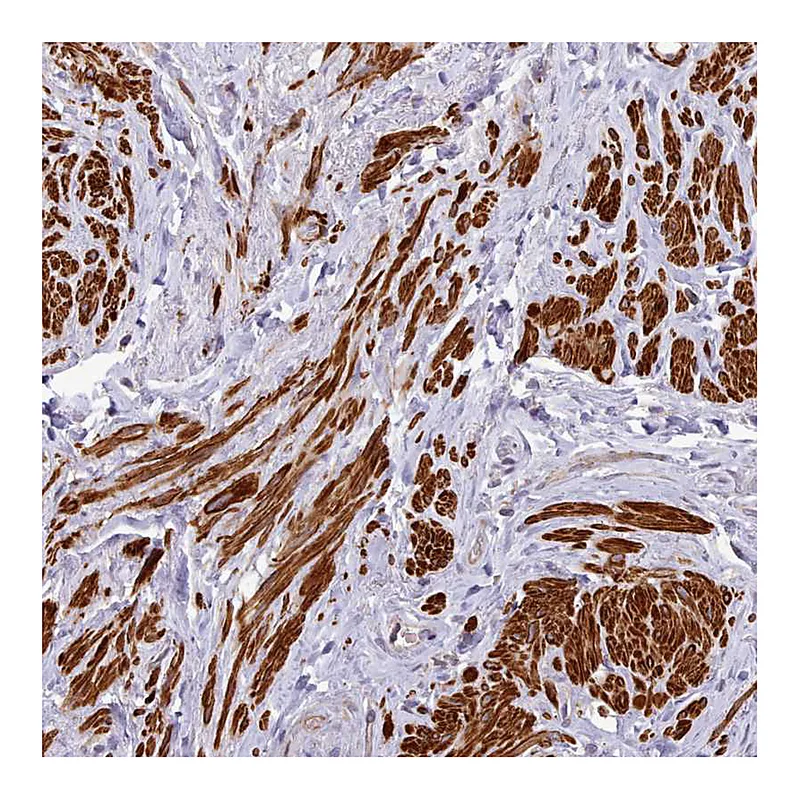 Atlas Antibodies Anti-NLRC4 Antibody