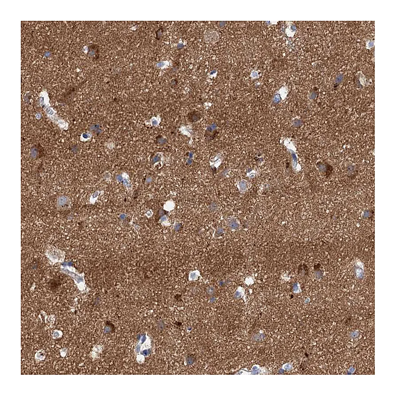 Atlas Antibodies Anti-NLRP10 Antibody
