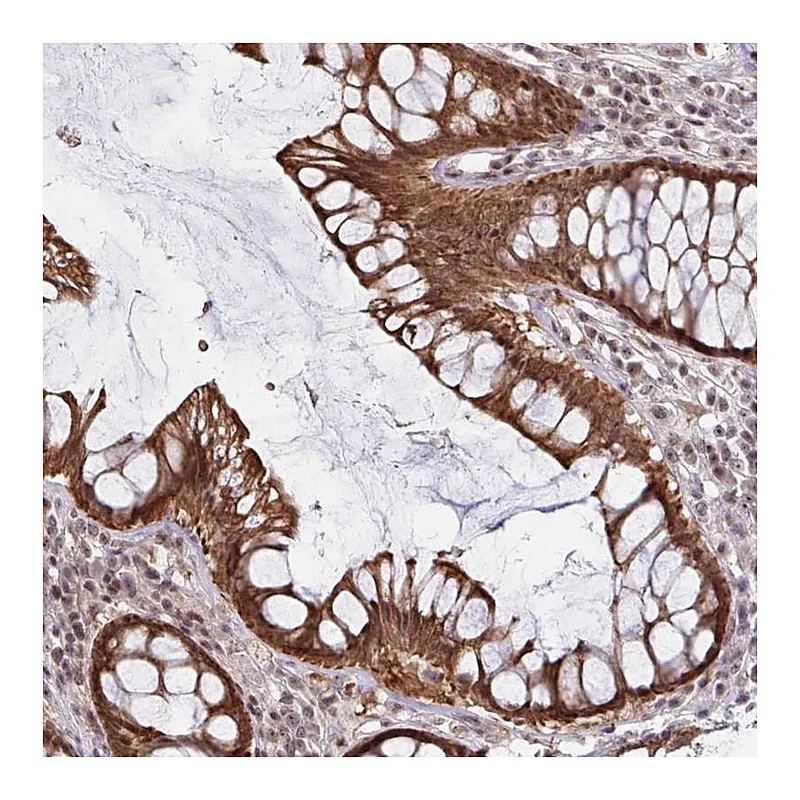 Atlas Antibodies Anti-NLRP13 Antibody