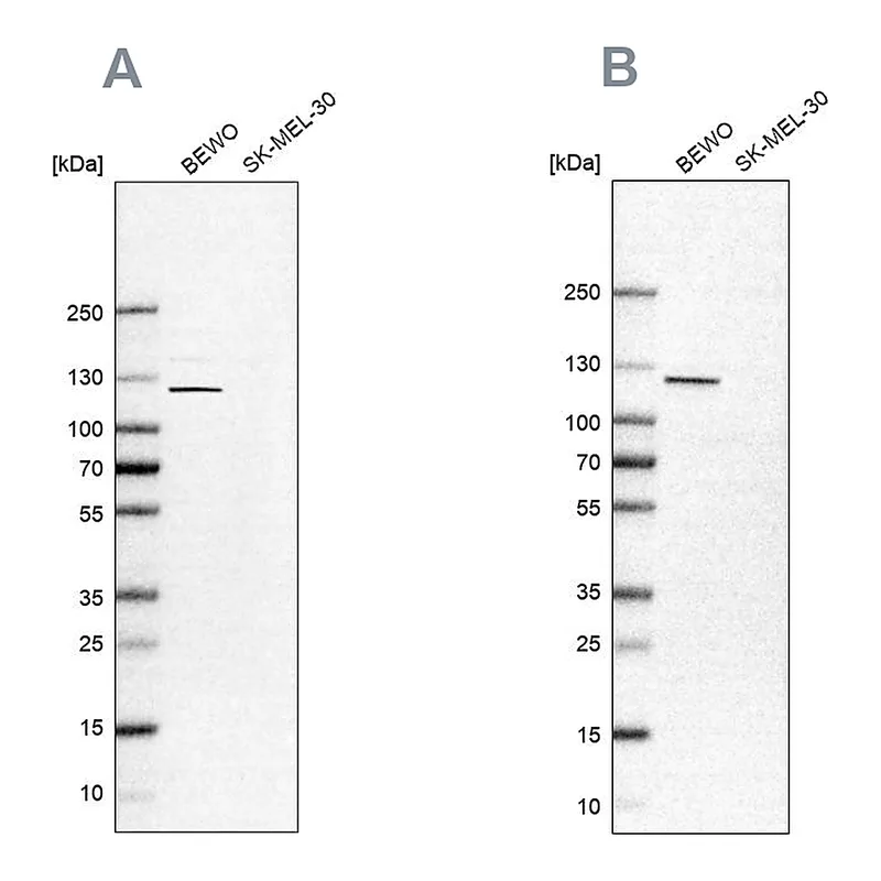 Atlas Antibodies Anti-NLRP2 Antibody