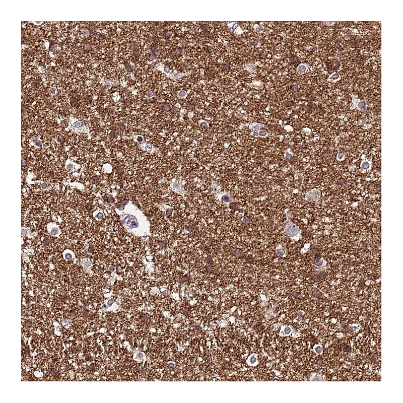 Atlas Antibodies Anti-NLRP11 Antibody