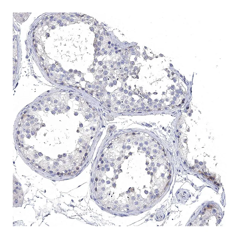 Atlas Antibodies Anti-NLRP14 Antibody