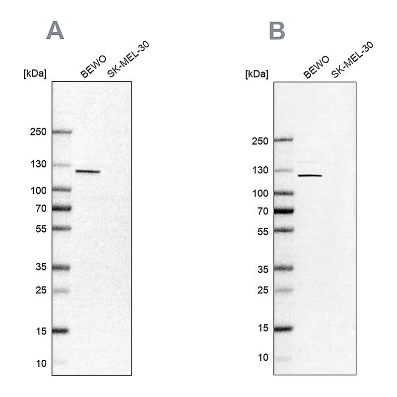 Atlas Antibodies Anti-NLRP2 Antibody