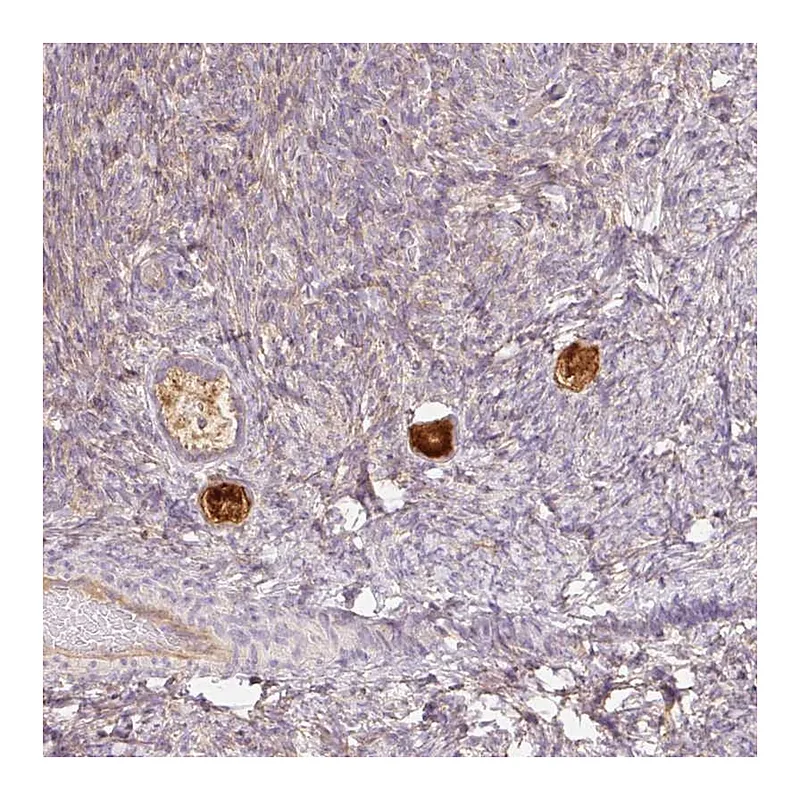 Atlas Antibodies Anti-NLRP5 Antibody
