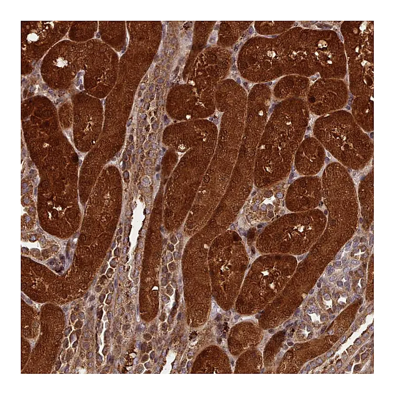 Atlas Antibodies Anti-NLRP7 Antibody