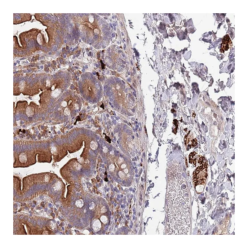 Atlas Antibodies Anti-NLRP6 Antibody