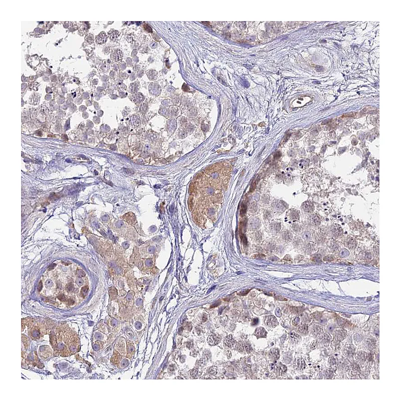 Atlas Antibodies Anti-NLRP9 Antibody