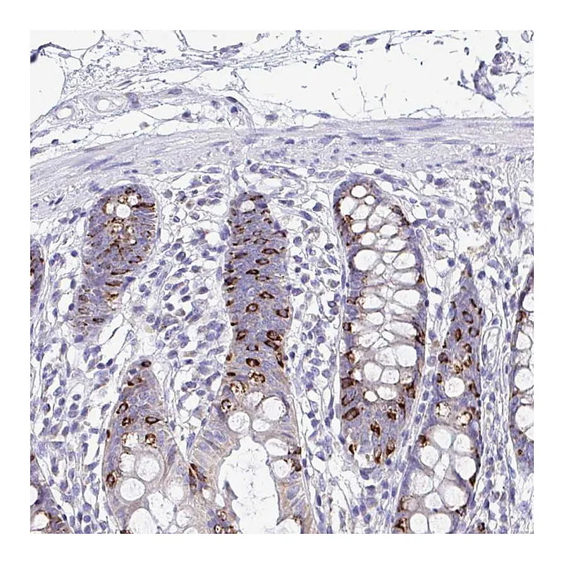 Atlas Antibodies Anti-NLRP8 Antibody