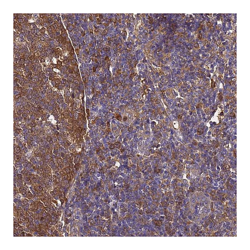 Atlas Antibodies Anti-NME1 Antibody