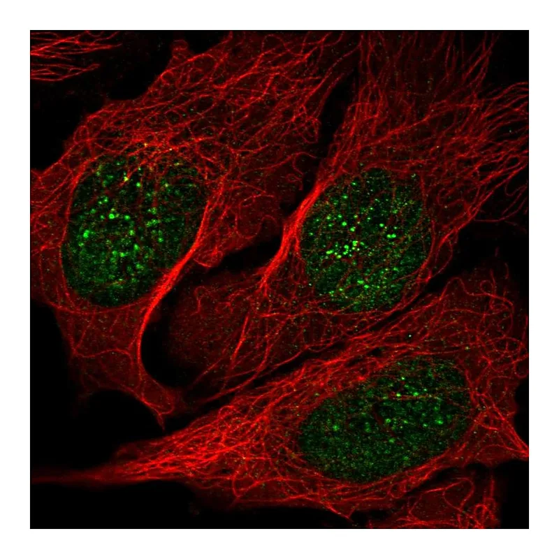 Atlas Antibodies Anti-NME3 Antibody