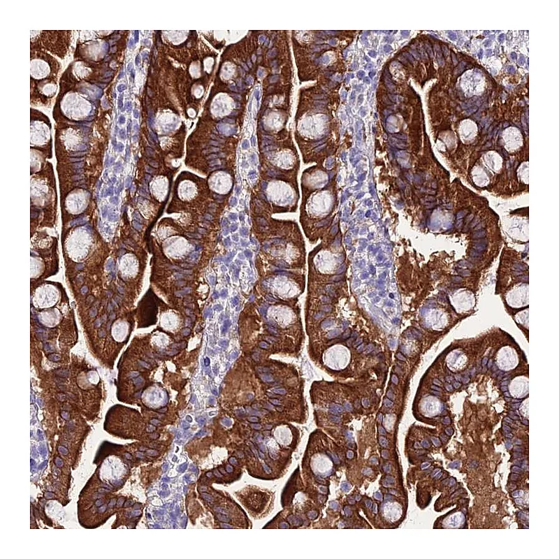 Atlas Antibodies Anti-NLRP6 Antibody