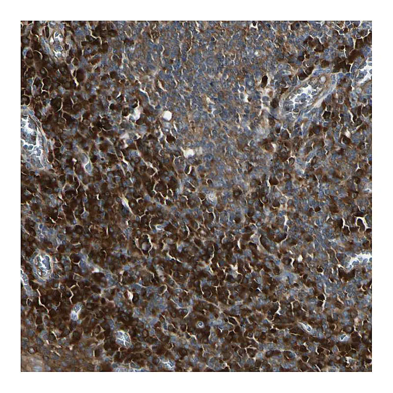 Atlas Antibodies Anti-NME1 Antibody