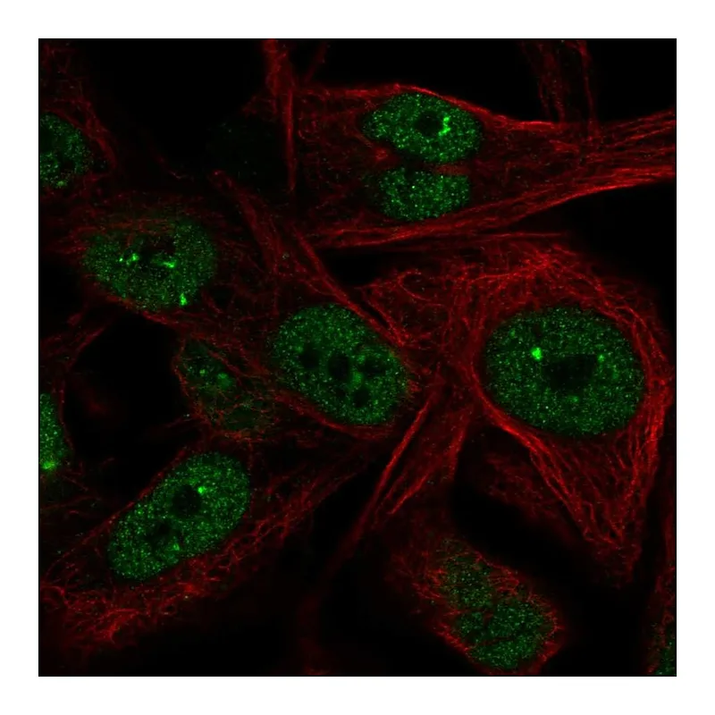 Atlas Antibodies Anti-NME5 Antibody