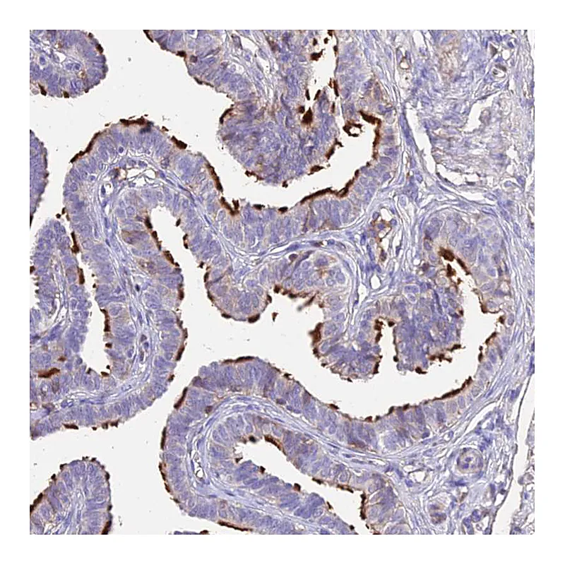 Atlas Antibodies Anti-NME5 Antibody