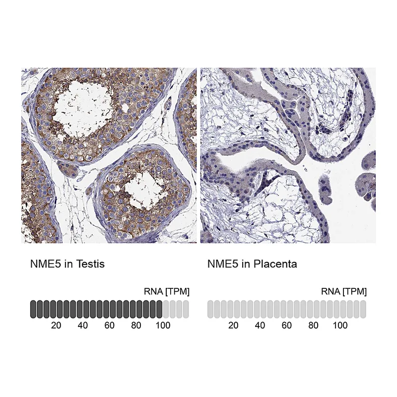 Atlas Antibodies Anti-NME5 Antibody
