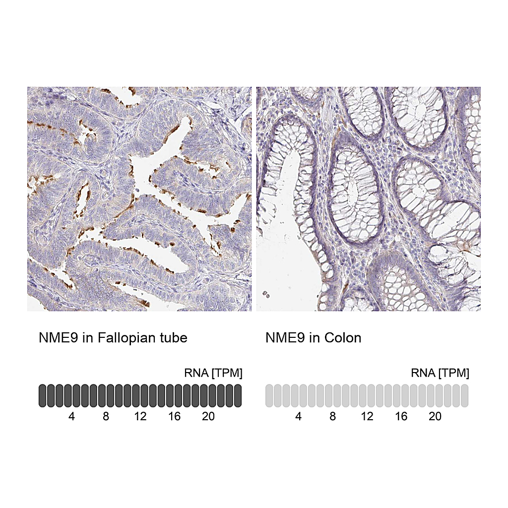 Atlas Antibodies Anti-NME9 Antibody