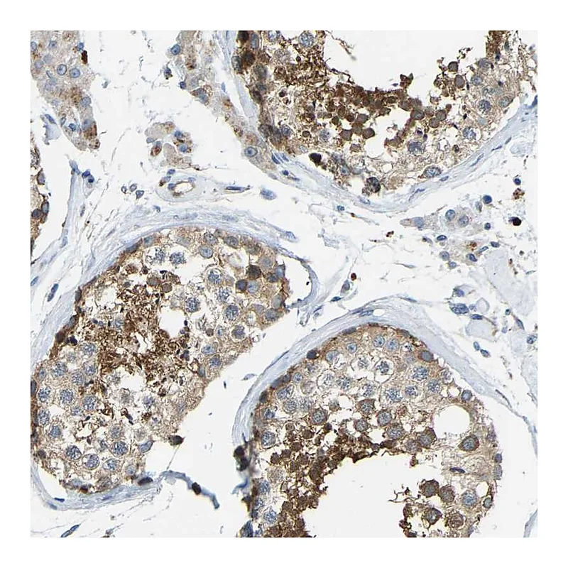 Atlas Antibodies Anti-NME8 Antibody