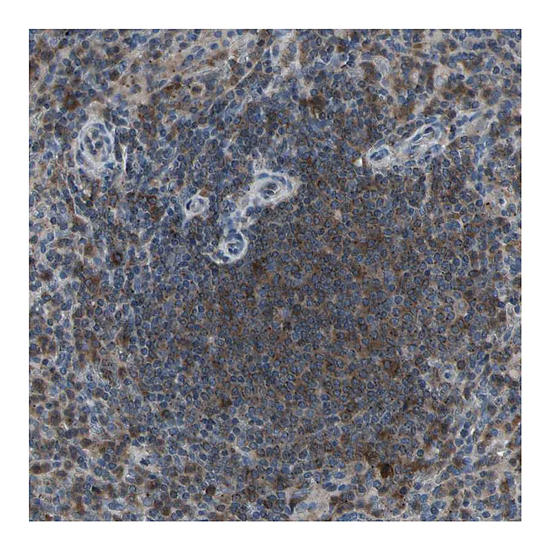 Atlas Antibodies Anti-NMI Antibody