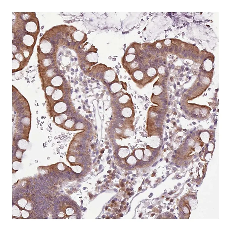Atlas Antibodies Anti-NMRK1 Antibody