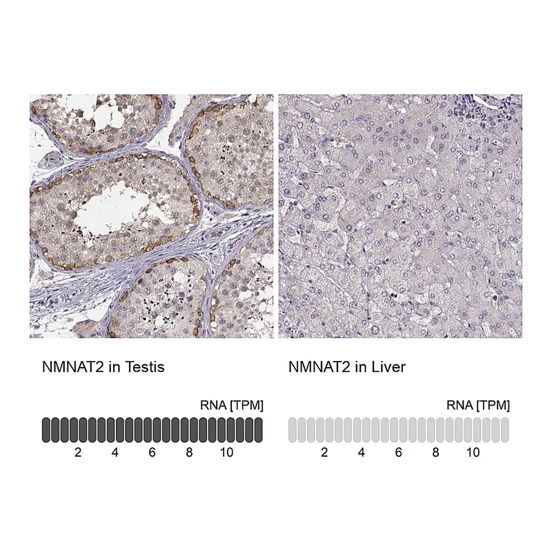 Atlas Antibodies Anti-NMNAT2 Antibody