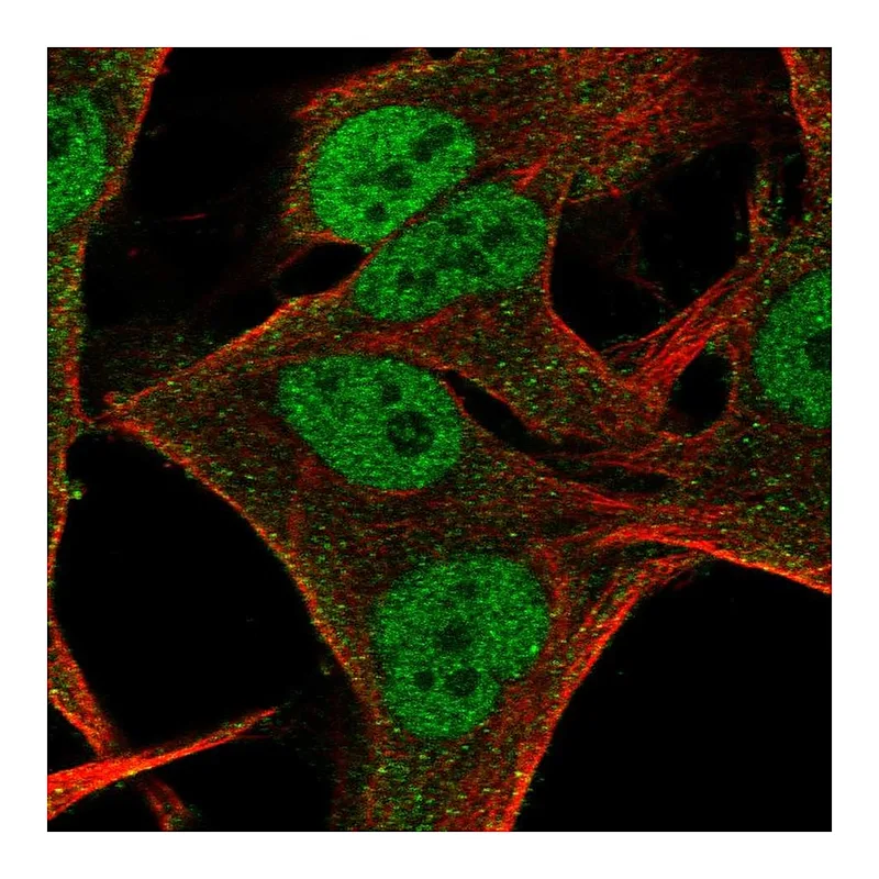Atlas Antibodies Anti-NMRK2 Antibody