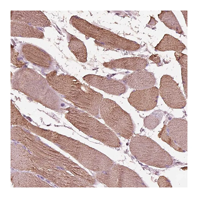 Atlas Antibodies Anti-NMRK2 Antibody