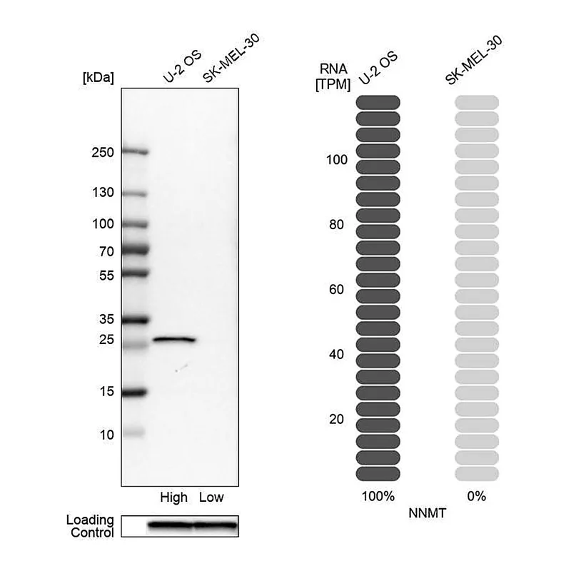 Atlas Antibodies Anti-NNMT Antibody
