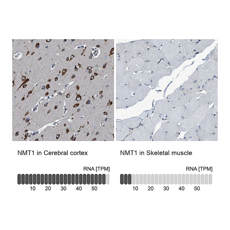 Atlas Antibodies Anti-NMT1 Antibody