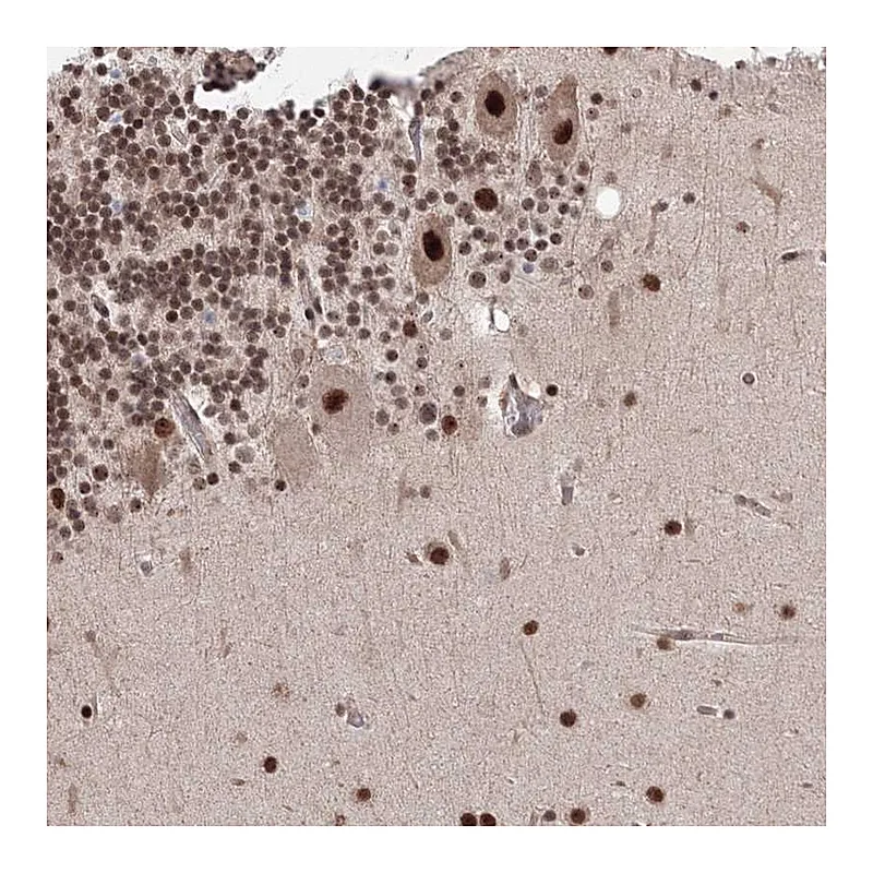 Atlas Antibodies Anti-NOA1 Antibody