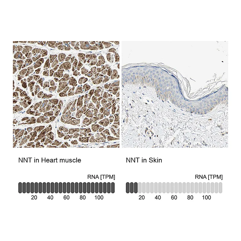 Atlas Antibodies Anti-NNT Antibody