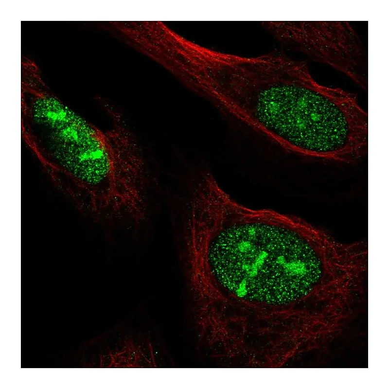 Atlas Antibodies Anti-NOC3L Antibody