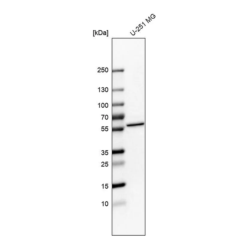 Atlas Antibodies Anti-NOC4L Antibody