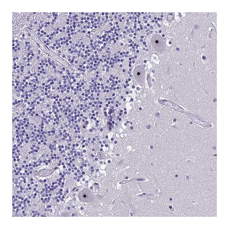 Atlas Antibodies Anti-NOC2L Antibody