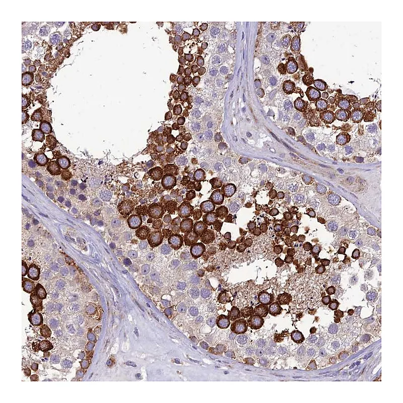 Atlas Antibodies Anti-NODAL Antibody