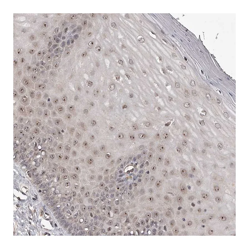 Atlas Antibodies Anti-NOL12 Antibody