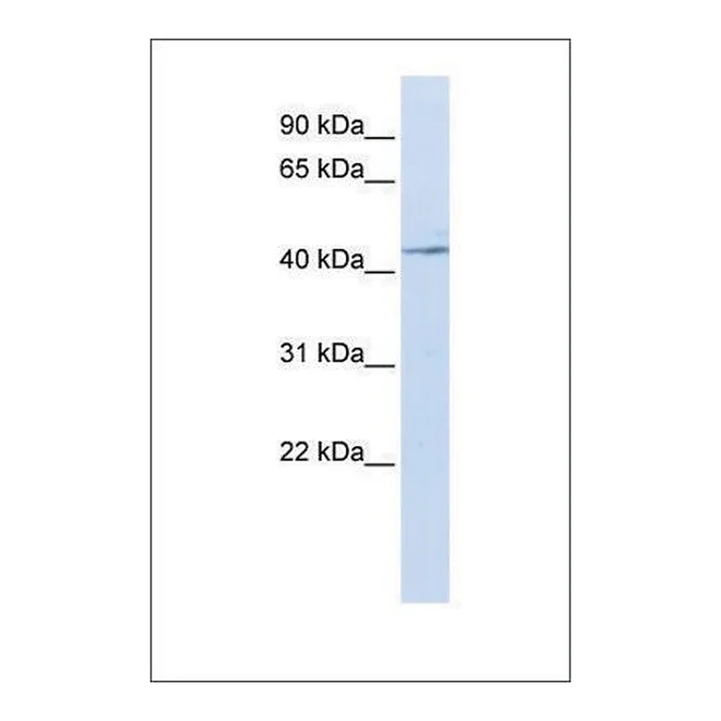 Merck Anti-IL11RA (ab1) antibody produced in rabbit