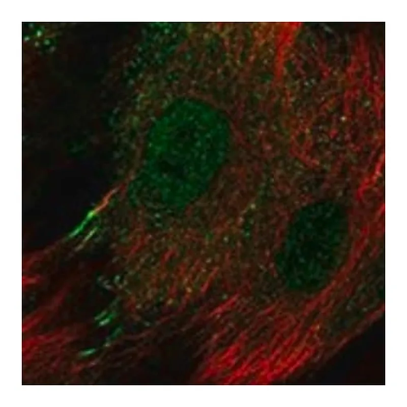 Merck Anti-IL13RA2 antibody produced in rabbit