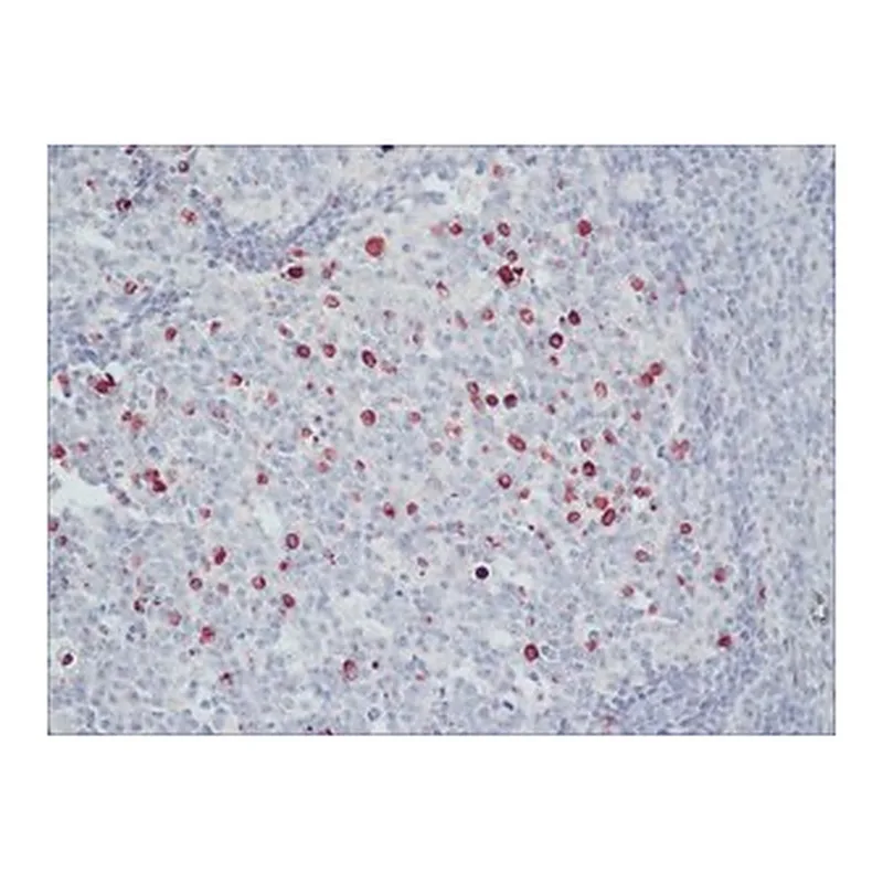 Merck ANTI-HUMAN IGM (MU CHAIN SPECIFIC)